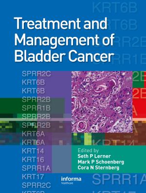 Treatment And Management Of Bladder Cancer Text With Cd Rom For Macintosh And Windows Tstc Bookstore Waco